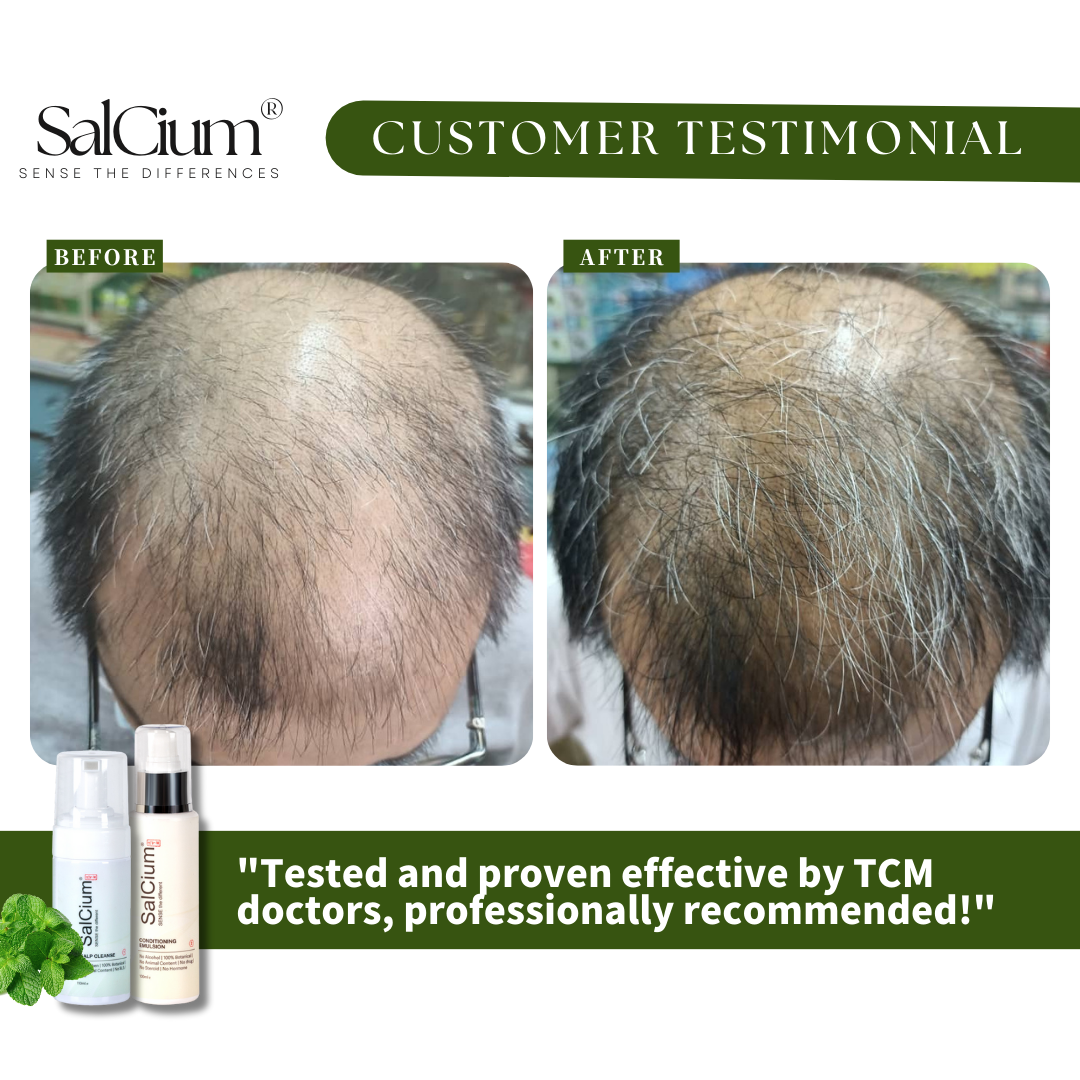 TCM Master’s Hair Regrowth Journey with SalCium