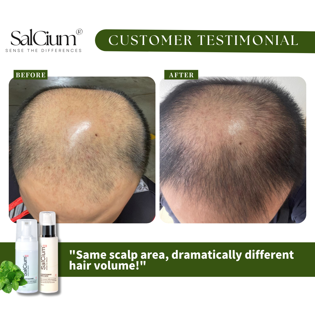 From Bald Spots to Fuller Hair: Real Results with SalCium