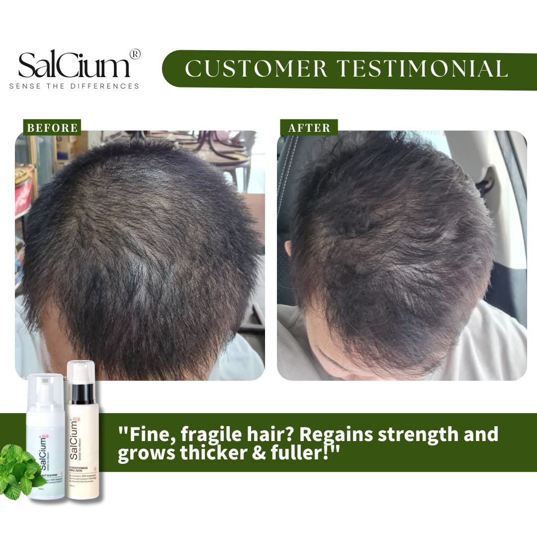 From Fragile to Fuller: How SalCium Transformed Fine Hair