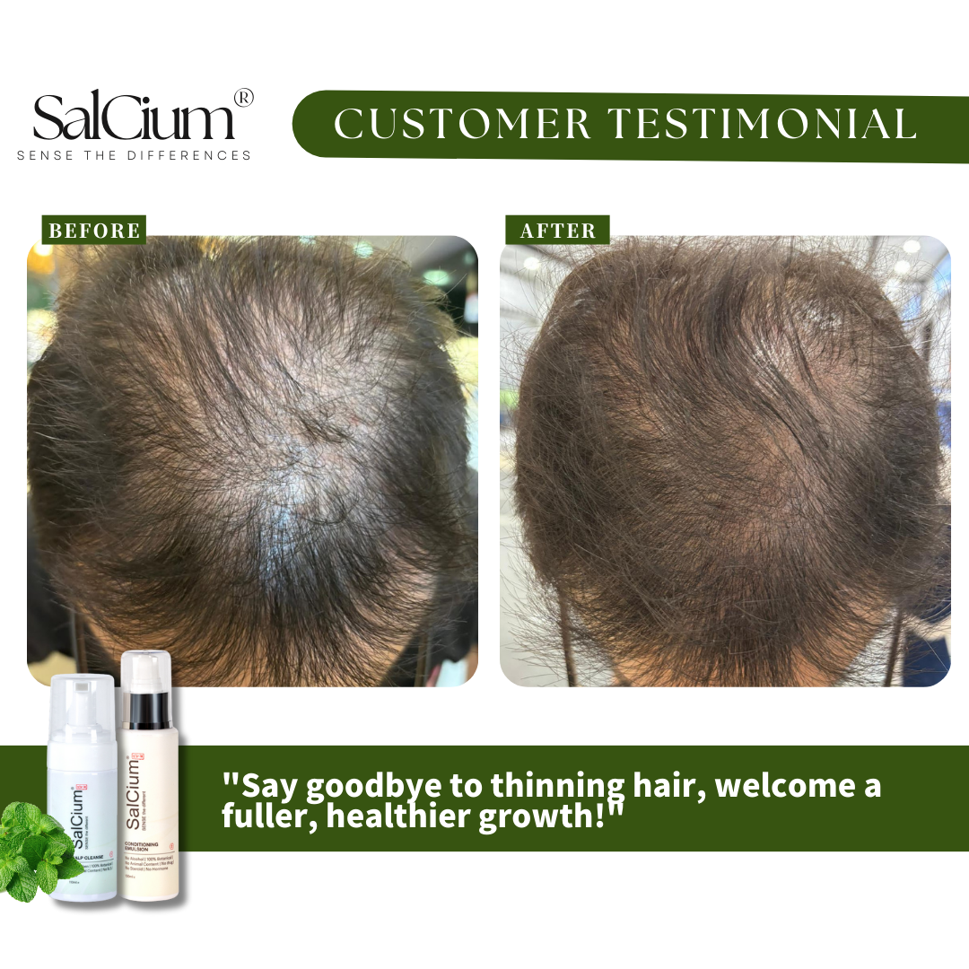 Say Goodbye to Thinning Hair: A 90-Day Journey to Fuller, Healthier Growth with Salcium®