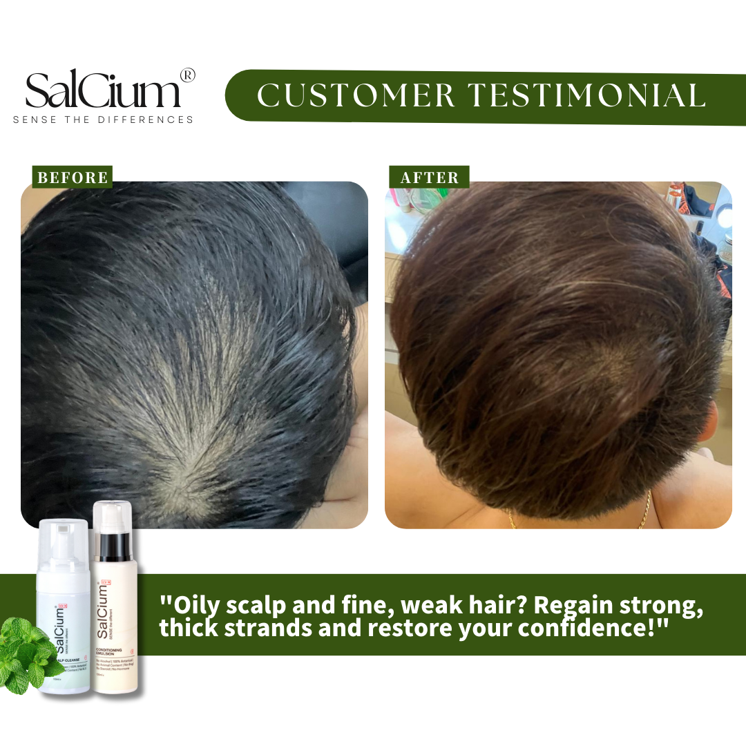 Combatting Oily Scalp and Fine Hair: A 90-Day Transformation to Strong, Thick Strands with Salcium®