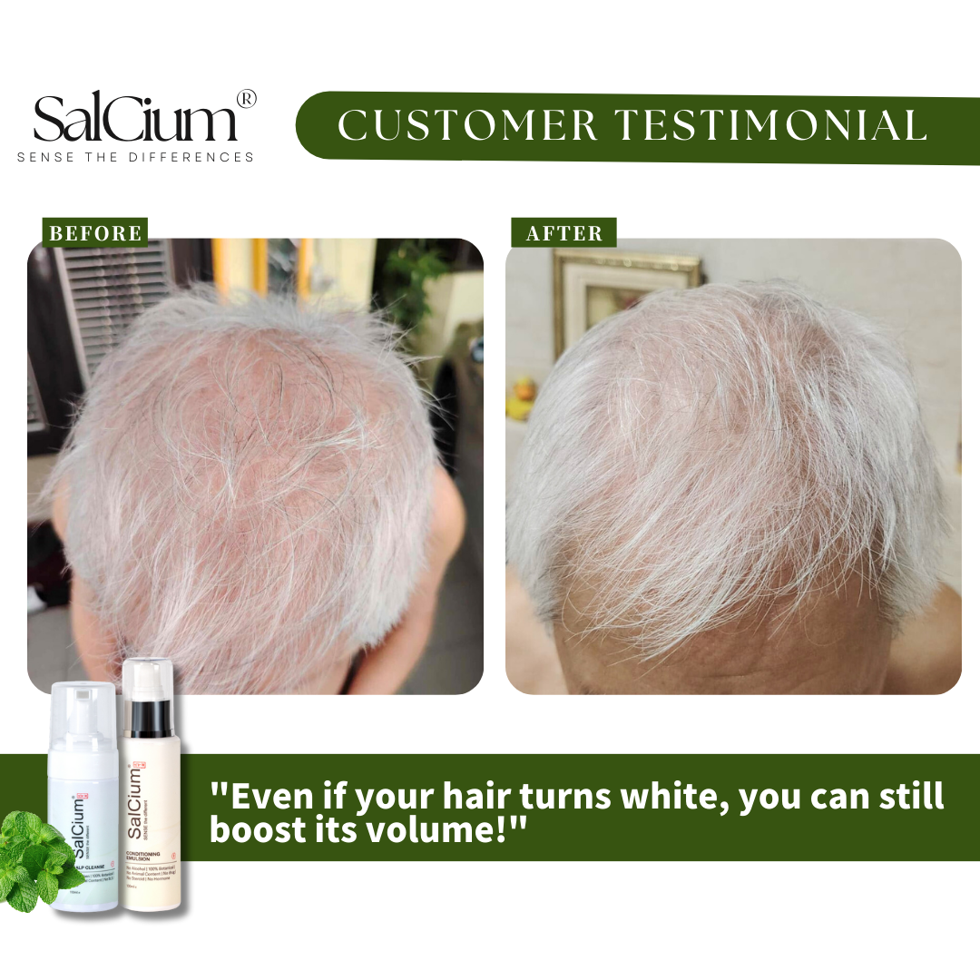 Boosting Volume in White Hair: A 90-Day Journey to Fuller, Healthier Strands with Salcium®