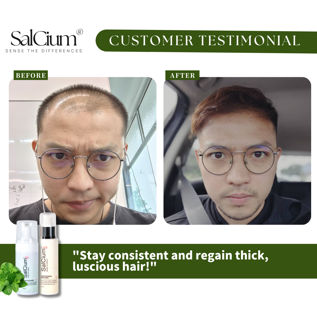 120-Day Hair Growth Transformation: A Medical Perspective on SalCium’s Breakthrough