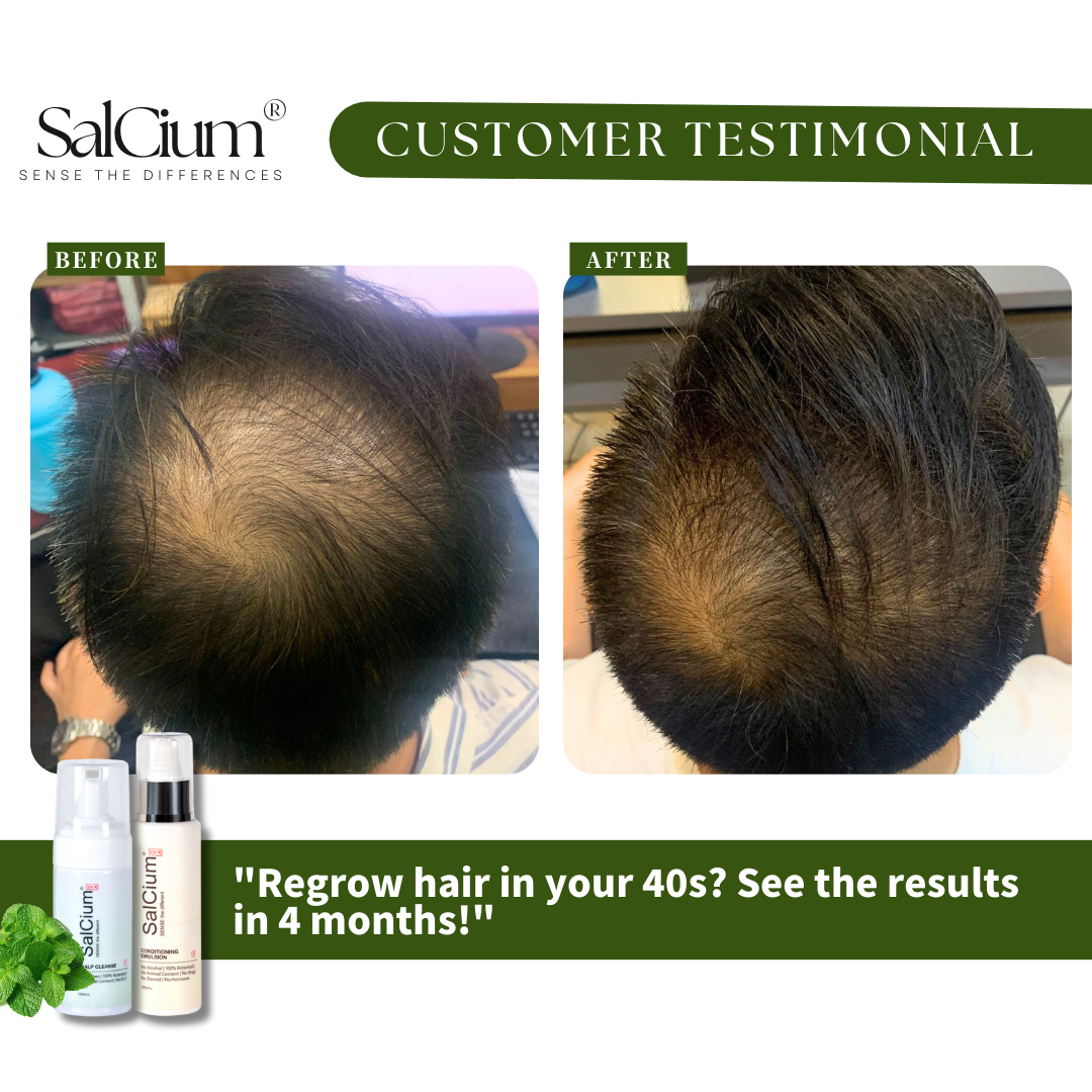 Regrow Hair in Your 40s? See the Results in Just 4 Months!