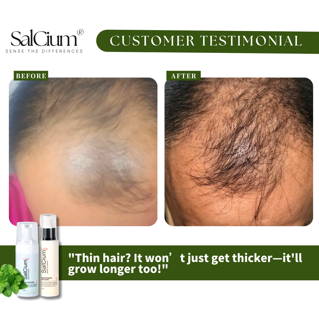 Thin Hair? It Won’t Just Get Thicker—It’ll Grow Longer Too!