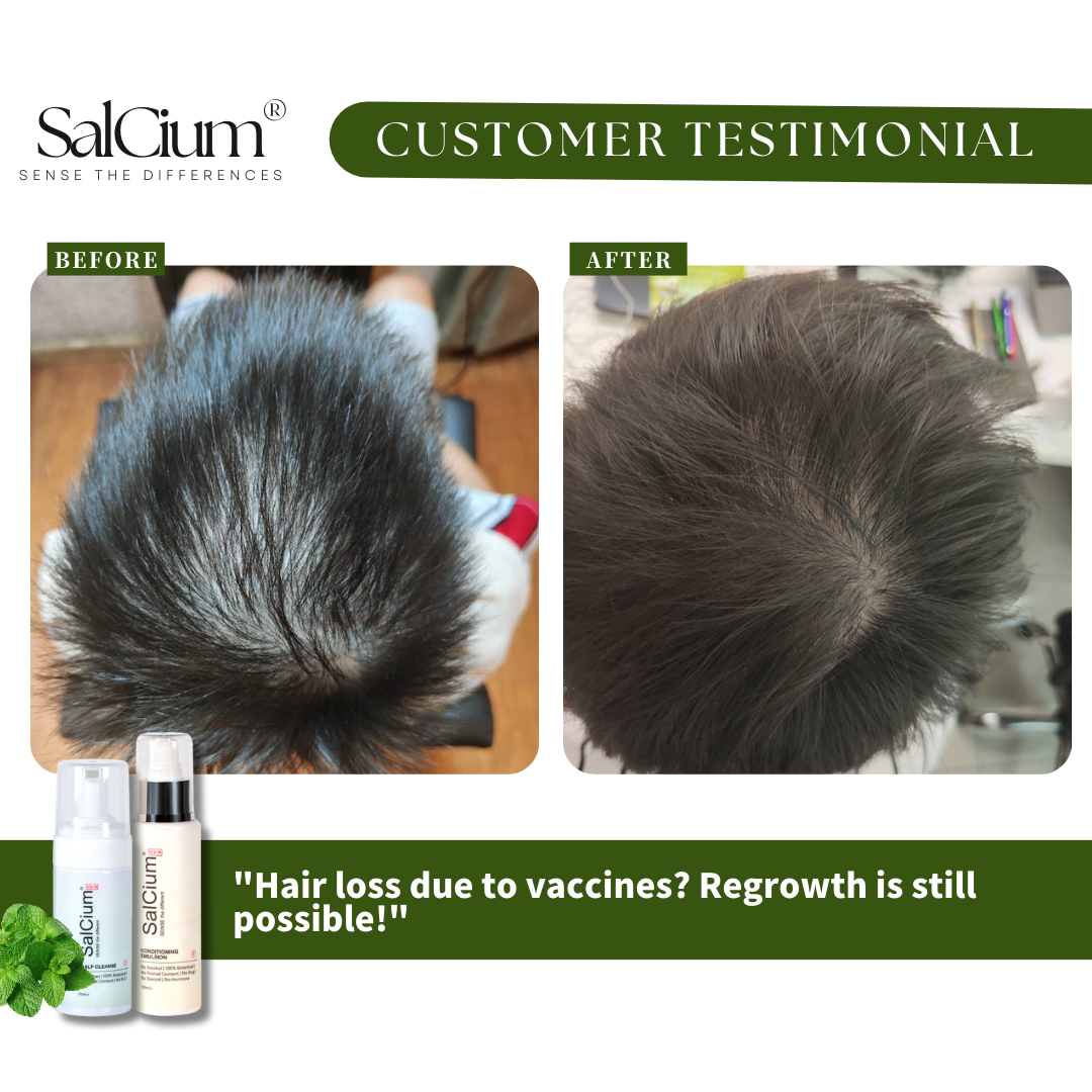 Jack’s Journey with SalCium and Thalassemia-Related Hair Loss
