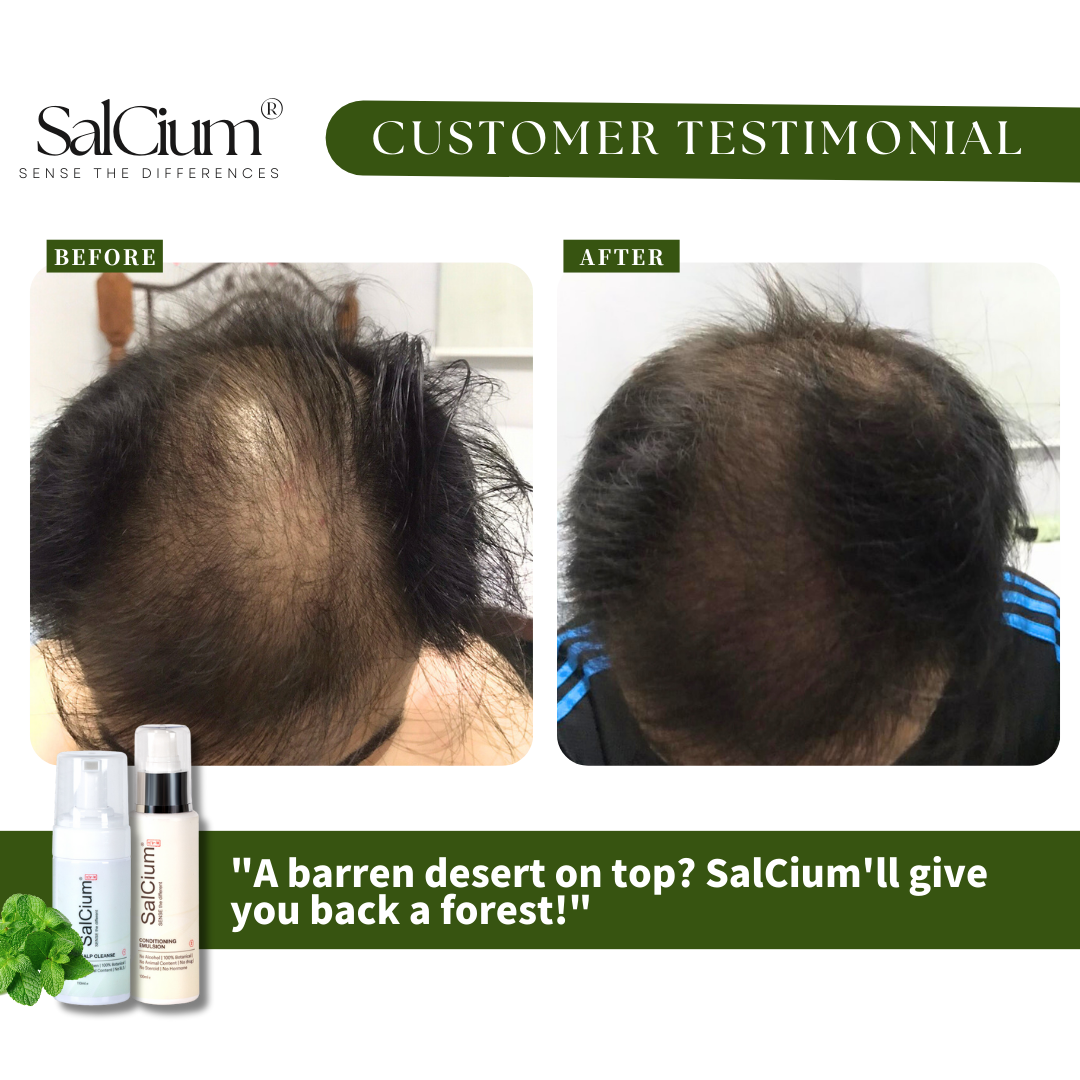 From a Barren Desert to a Lush Forest: A 90-Day Journey to Restored Hair with SalCium®