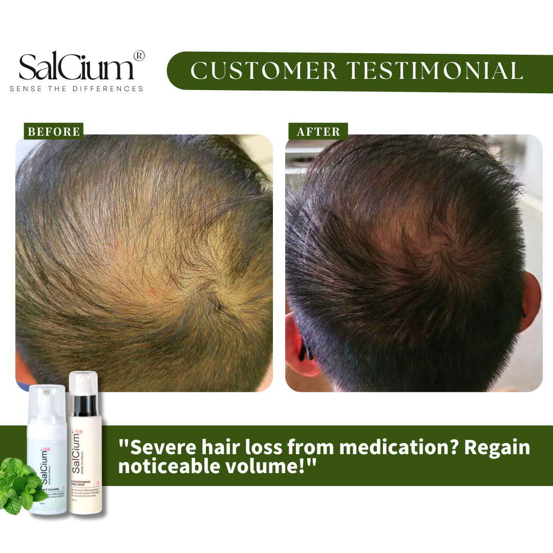 Overcoming Severe Hair Loss from Medication: A 120-Day Journey to Noticeable Volume with SalCium®