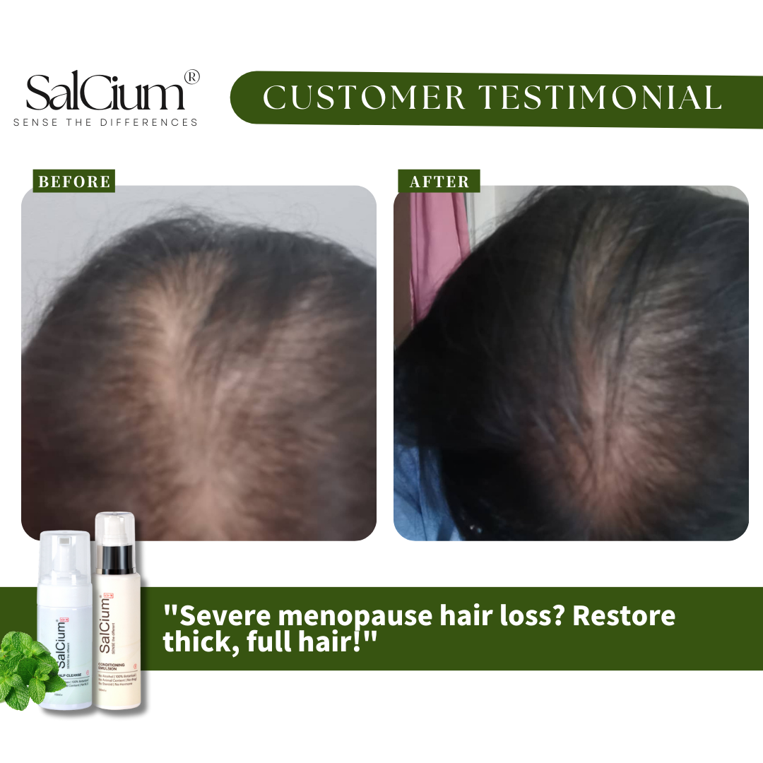 Reversing Severe Menopause Hair Loss: A 90-Day Journey to Thick, Full Hair with SalCium®