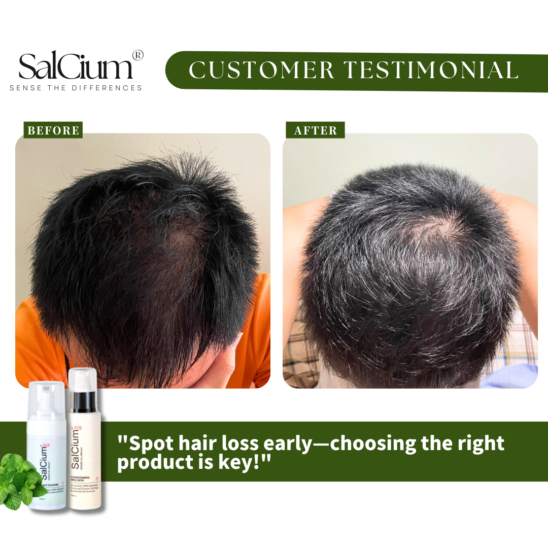 Spot Hair Loss Early and Win: A 90-Day Journey to Fuller Hair with SalCium®