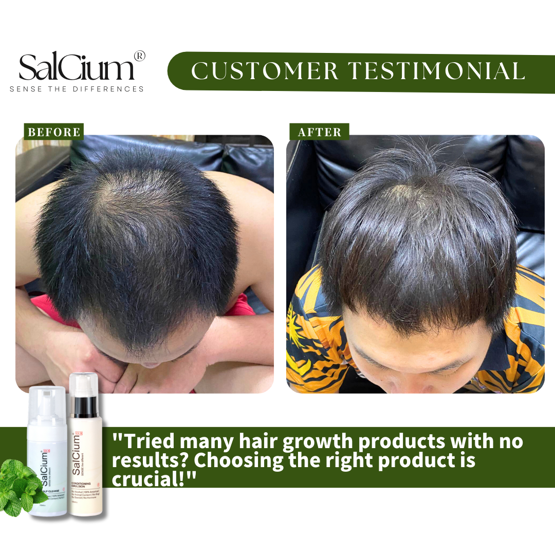 Finally Finding Success After Failed Hair Growth Products: A 90-Day Journey with SalCium®