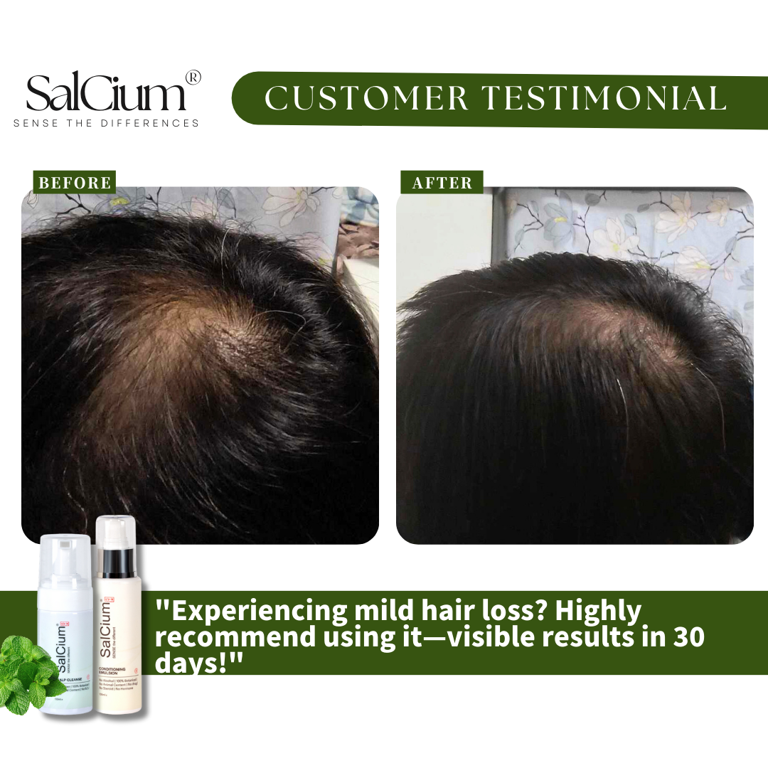 Tackling Mild Hair Loss: A 30-Day Journey to Visible Results with SalCium®