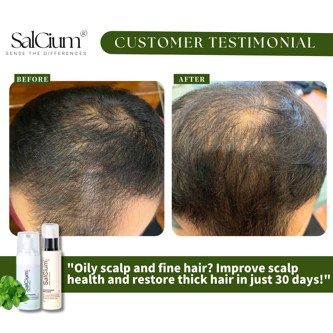 Transforming an Oily Scalp and Fine Hair: A 30-Day Journey to Thicker Hair with SalCium®