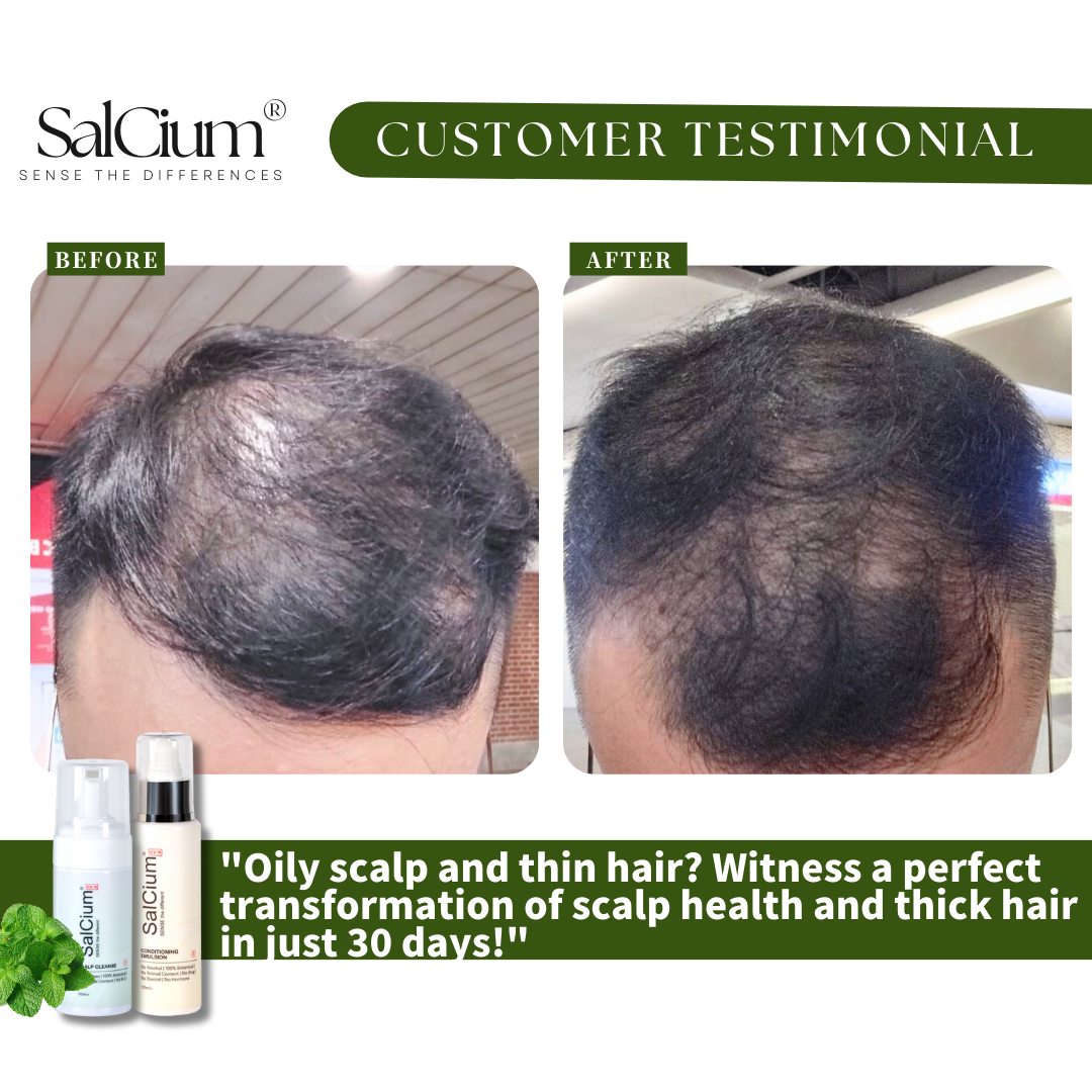 Transforming an Oily Scalp and Thin Hair: A 30-Day Journey to Thicker Hair with SalCium®