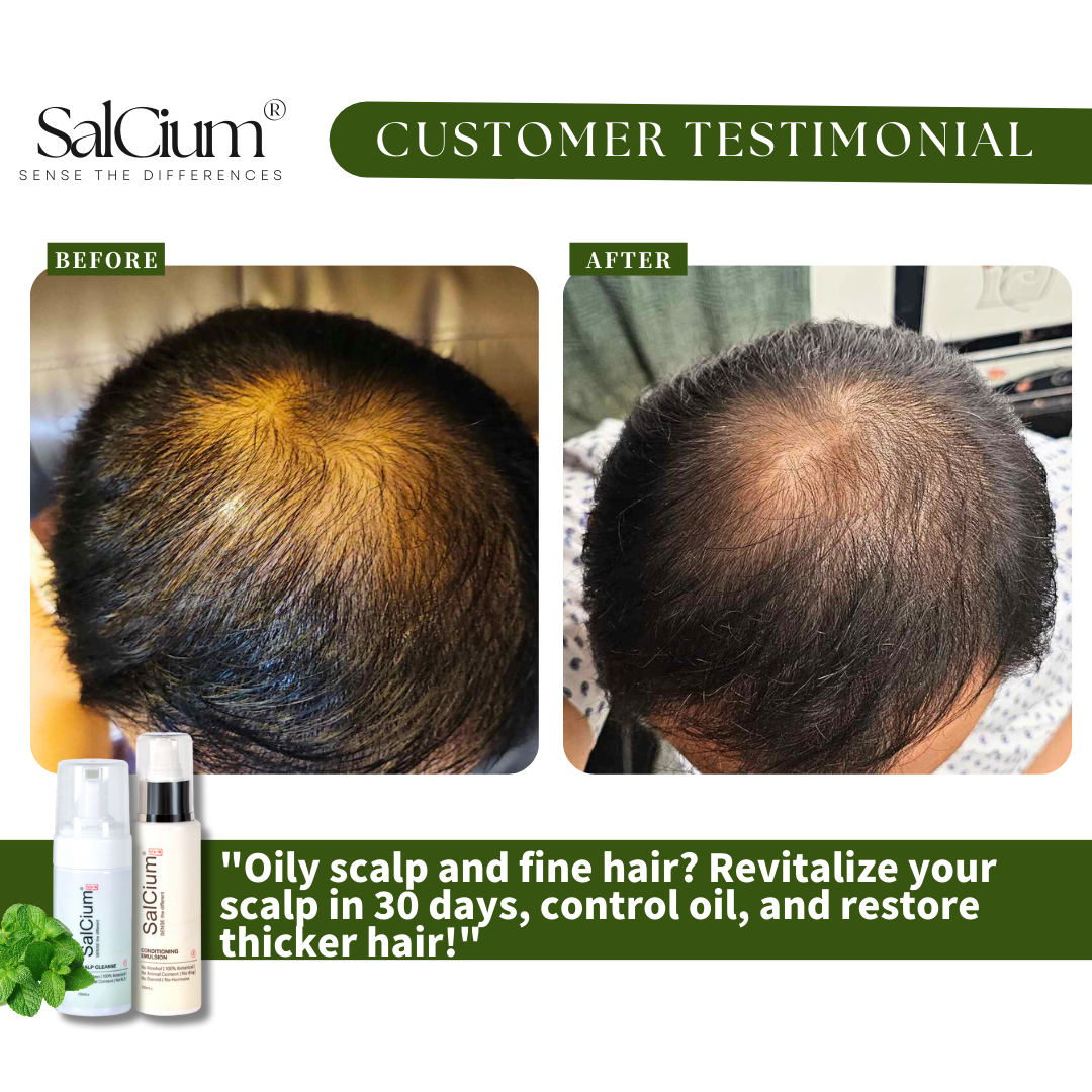 Revitalizing an Oily Scalp and Fine Hair: A 30-Day Journey to Thicker Hair with SalCium®