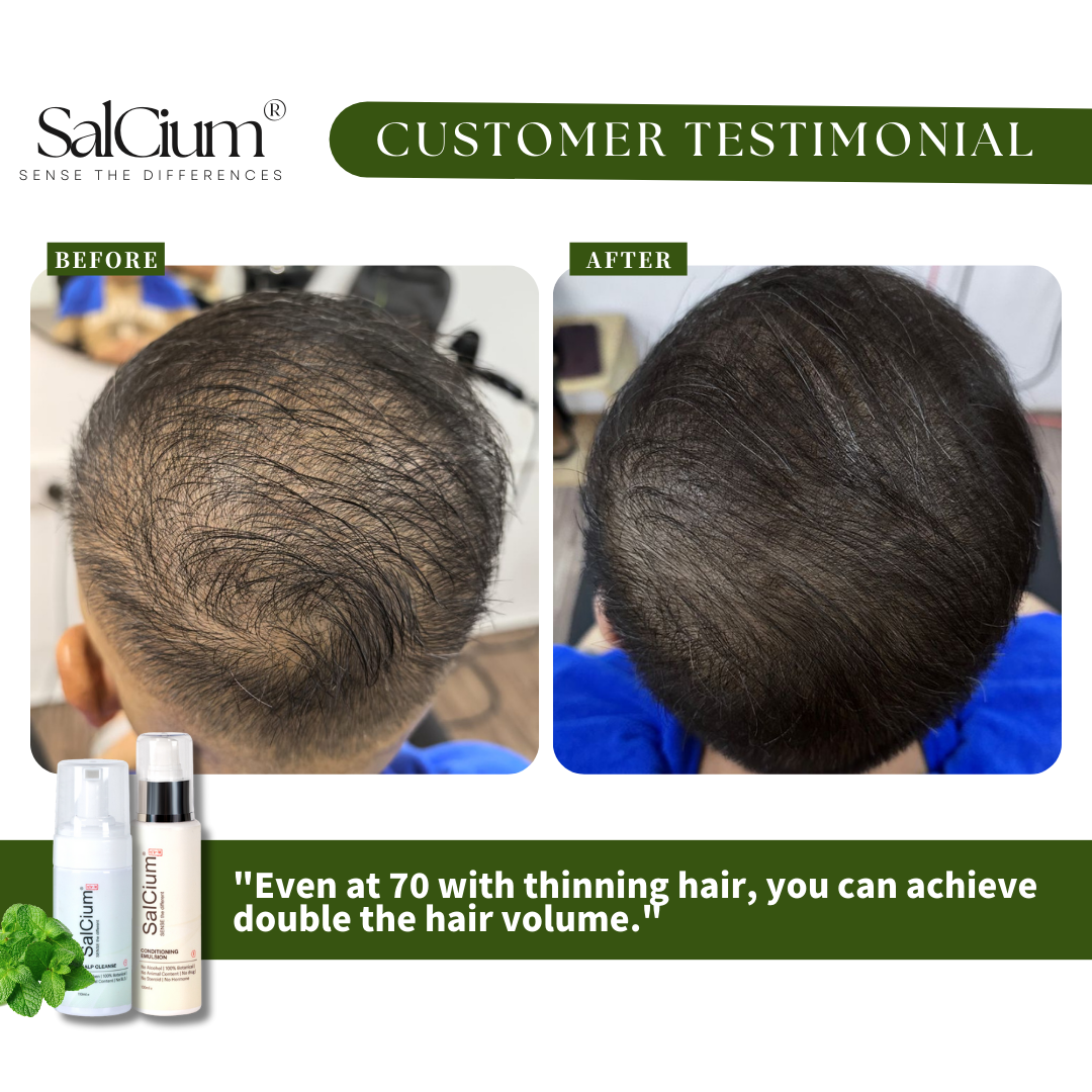 The Challenge: Age-Related Hair Thinning &amp; Scalp Aging
