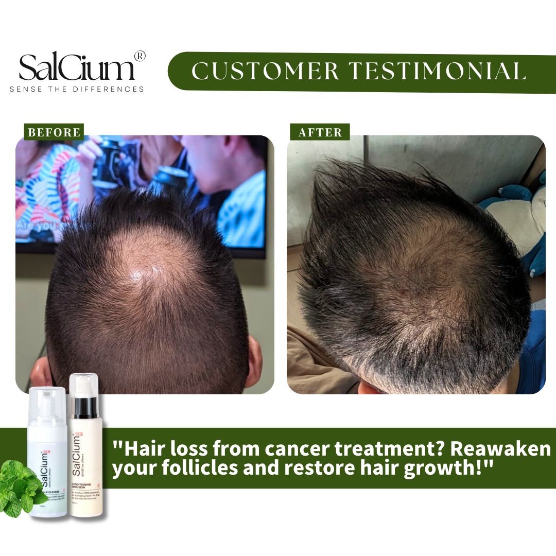 Reawakening Hope: Restoring Hair Growth After Cancer Treatment with SalClum®