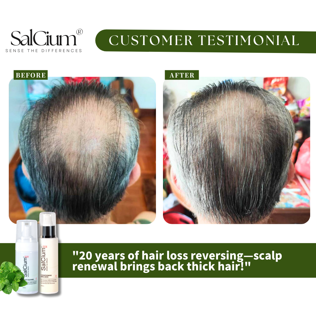 20 Years of Hair Loss Reversed? See the Transformation!