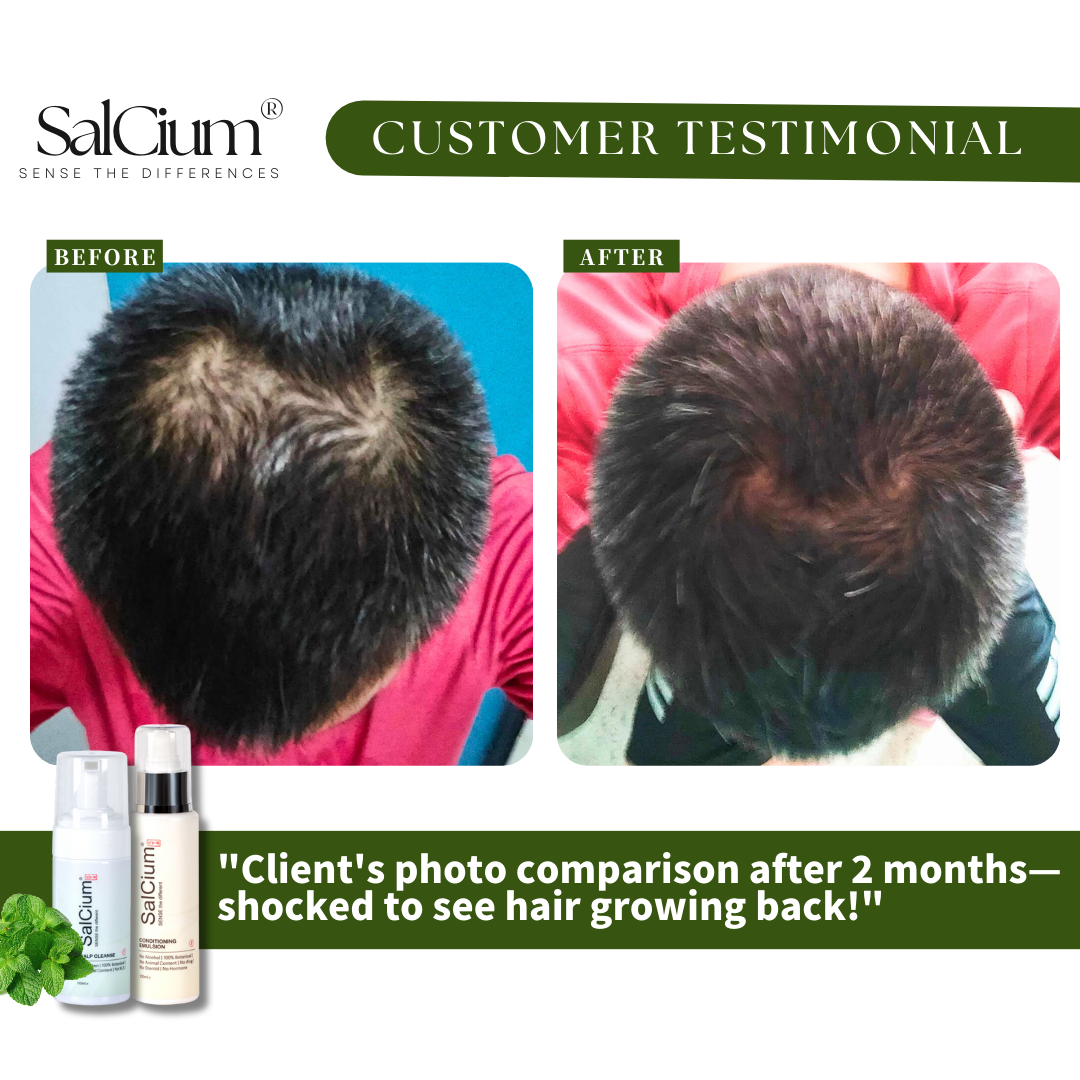 From Thinning to Thriving: 2-Month Hair Regrowth Journey!