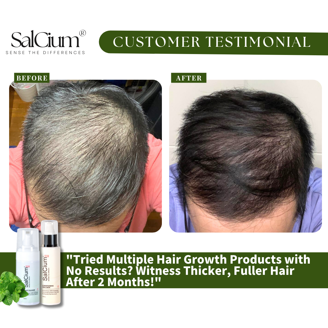 Two Months to Thicker Hair: My SalCium Hair Growth Journey