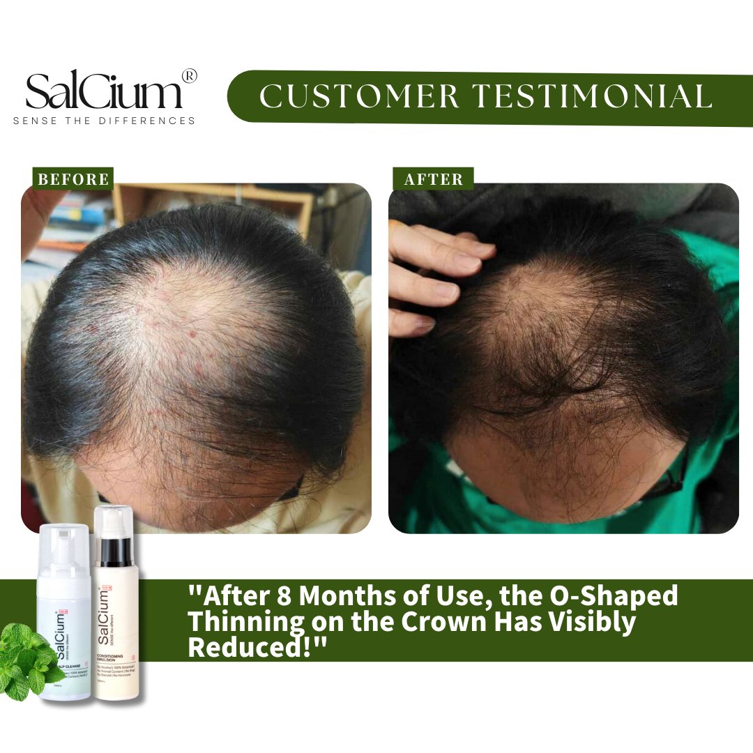 8 Months to Reduced Thinning: My SalCium Scalp Care Journey