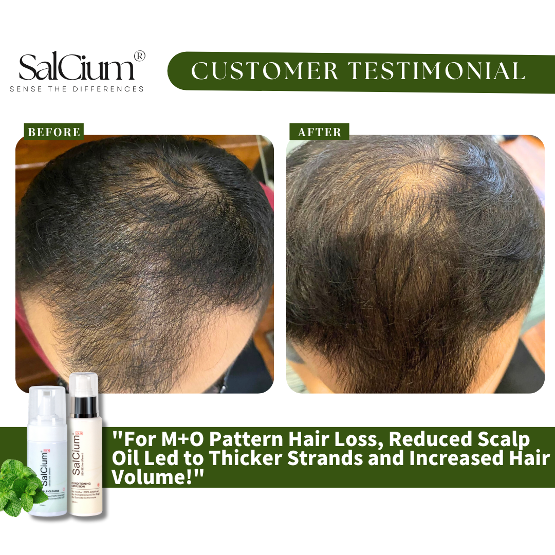 SalCium Scalp Care: The Secret to a Healthier Scalp & Stronger Hair