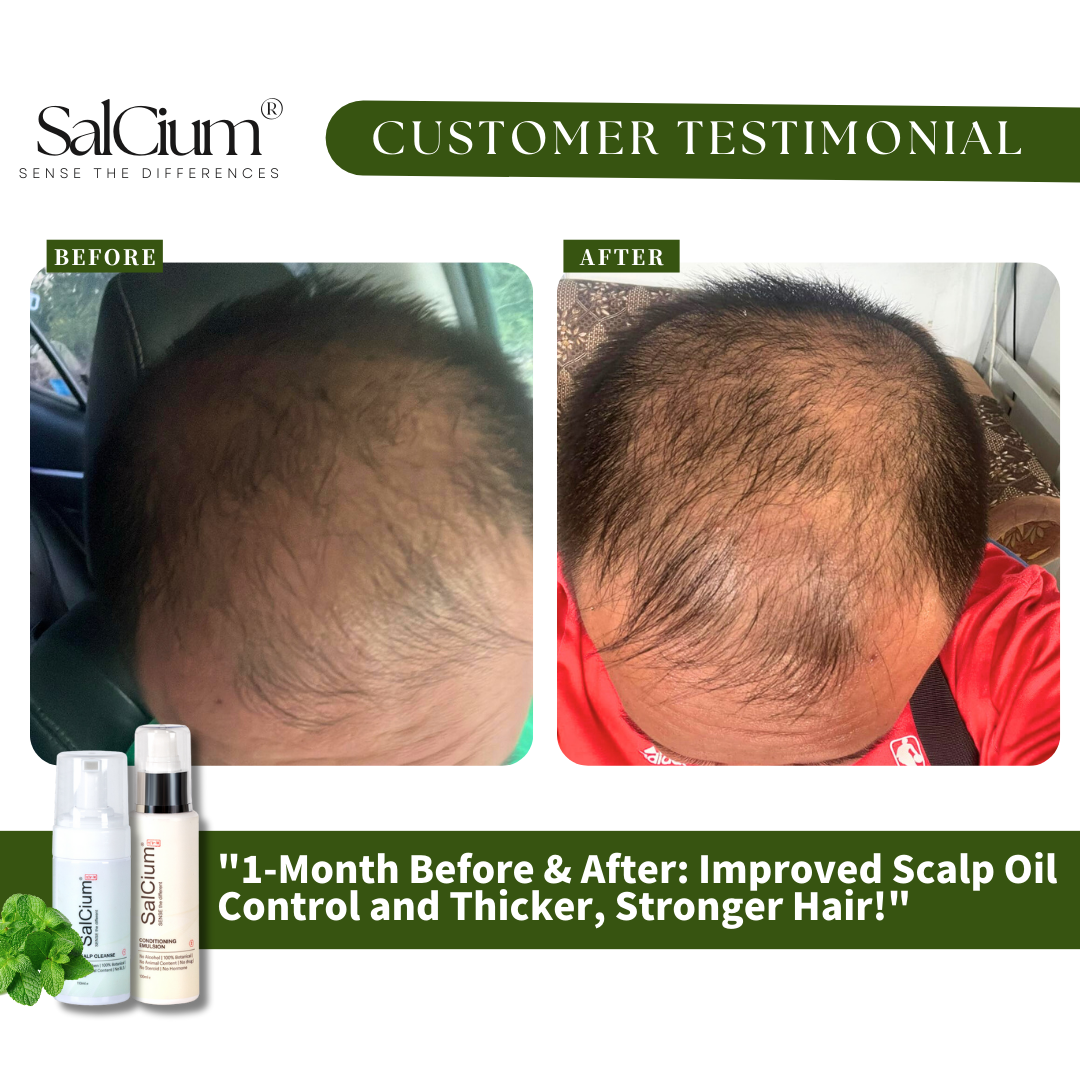 1-Month Hair Transformation: How SaiCium Improved Scalp Oil Control & Hair Thickness