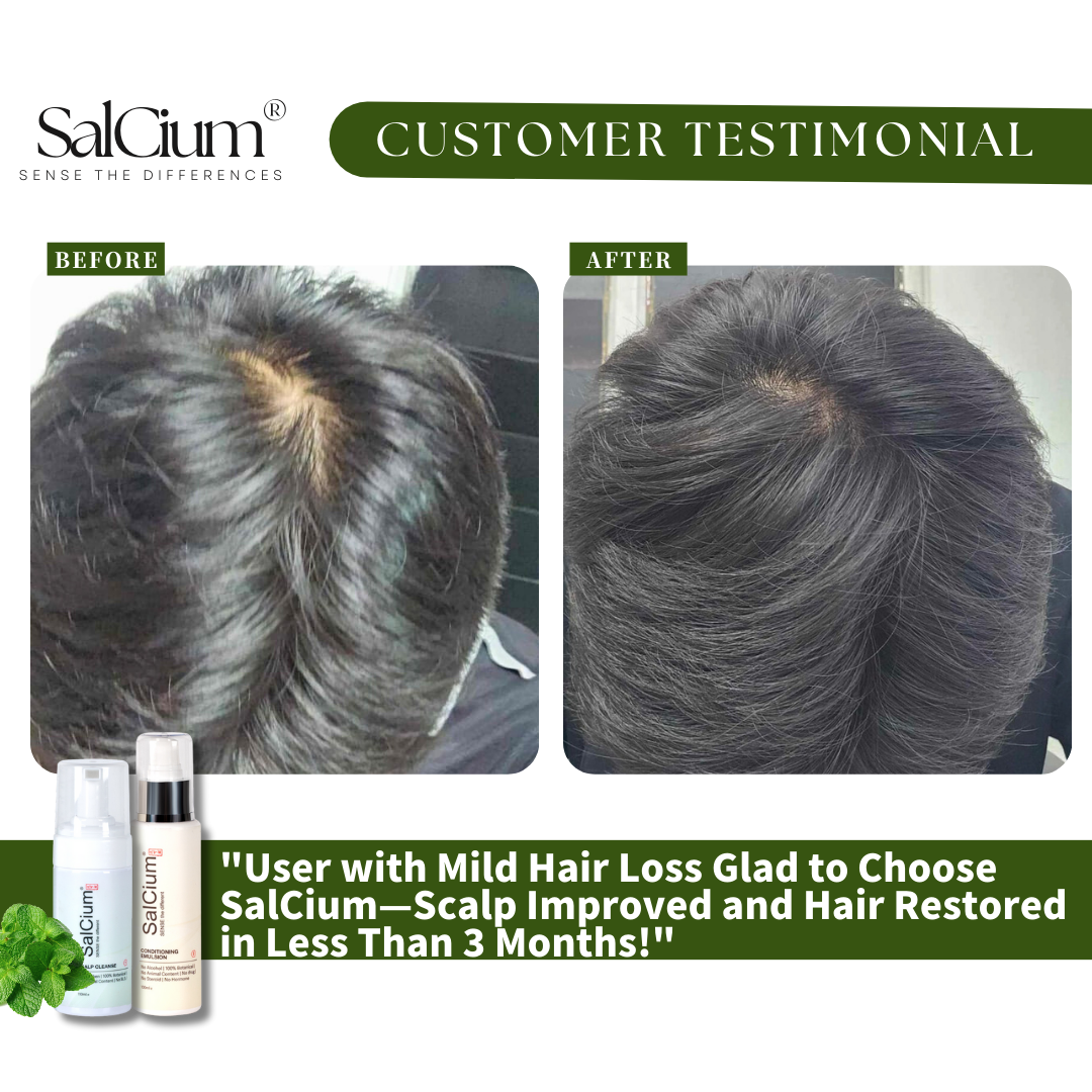 From Mild Thinning to Renewed Confidence: A SalCium Success Story in Just 3 Months