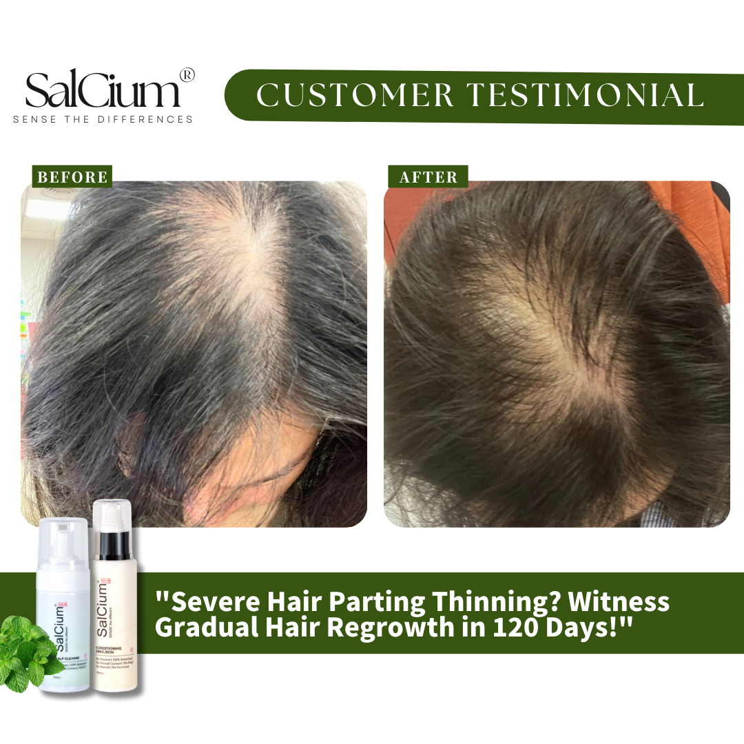 The Reality of Hair Parting Thinning