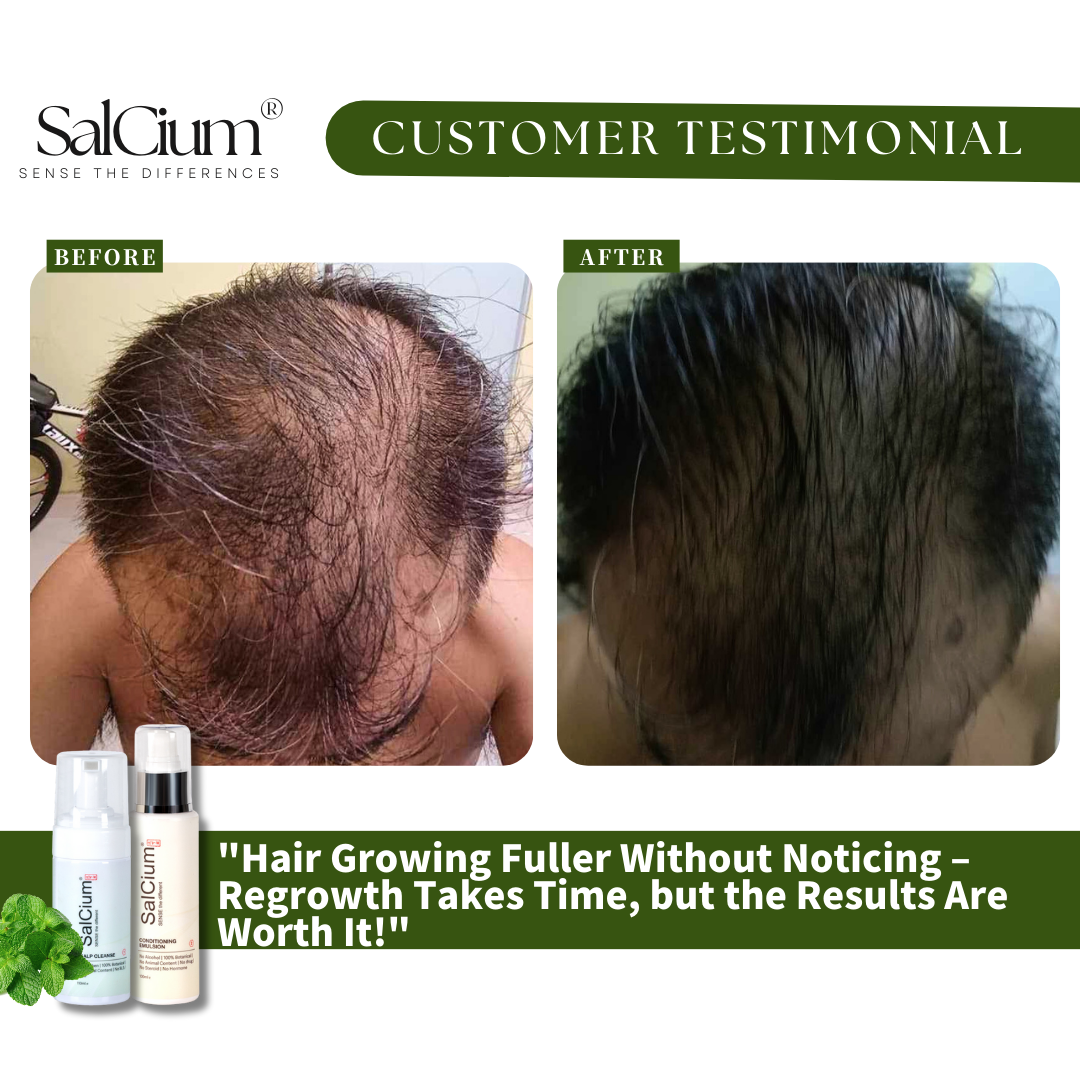 Patience Pays Off: Fuller, Healthier Hair Growth Journey!