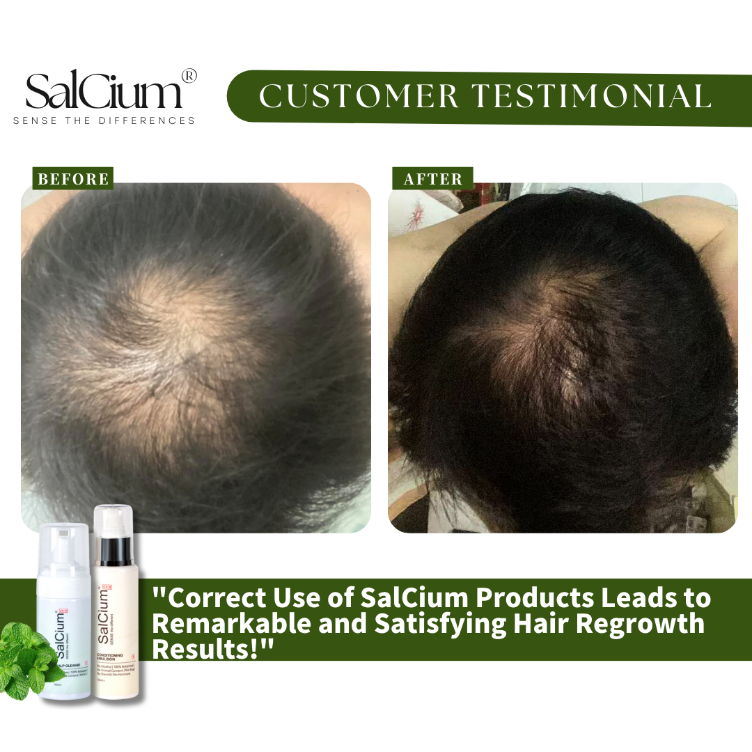 Unlocking Hair Regrowth: How Proper Use of SaiCium Delivers Remarkable Results