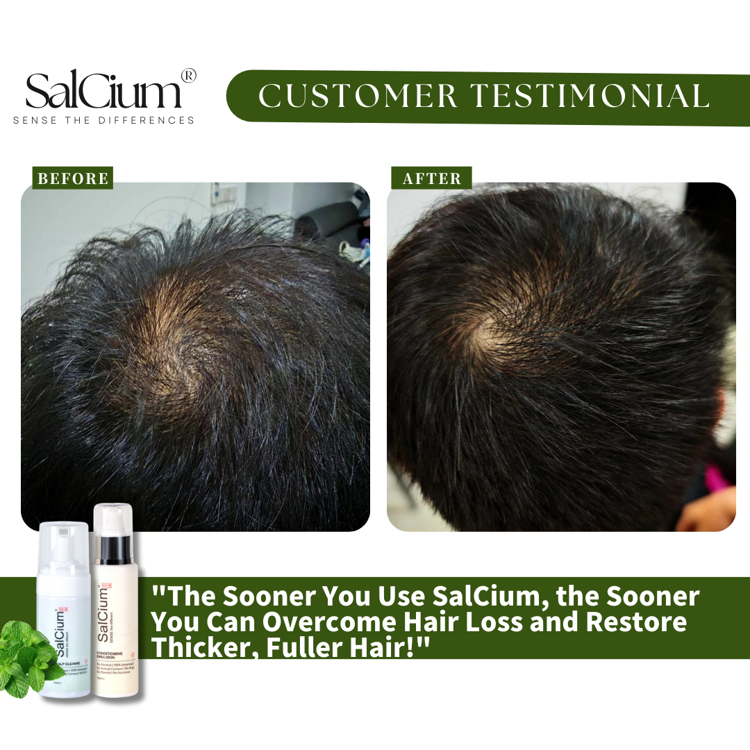Early Action = Better Results: Why Starting SalCium Now Beats Waiting