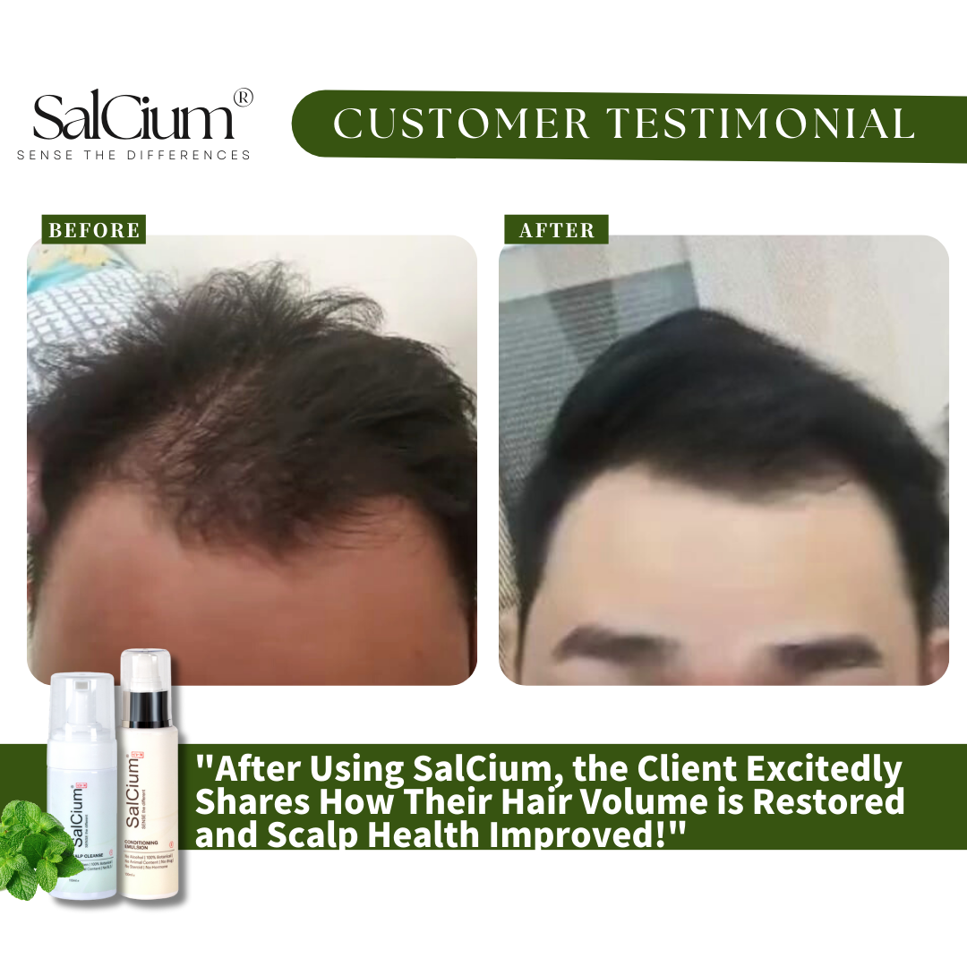 From Flat to Full: A Hair Transformation With SalCium