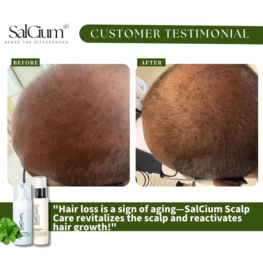 Turning Back the Clock: How SalCium Scalp Care Combats Age-Related Hair Loss