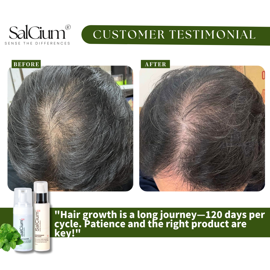 A 120-Day Journey to Fuller Hair: My Experience with SalCium Scalp Care