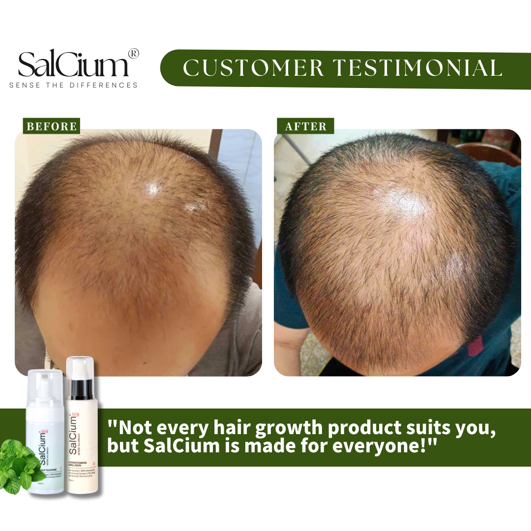 One Solution for All: How SaiCium Delivers Real Results for Every Hair Type