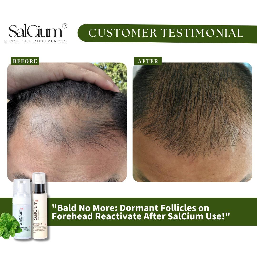 From Receding to Regrowing – SalCium’s Proven Results!
