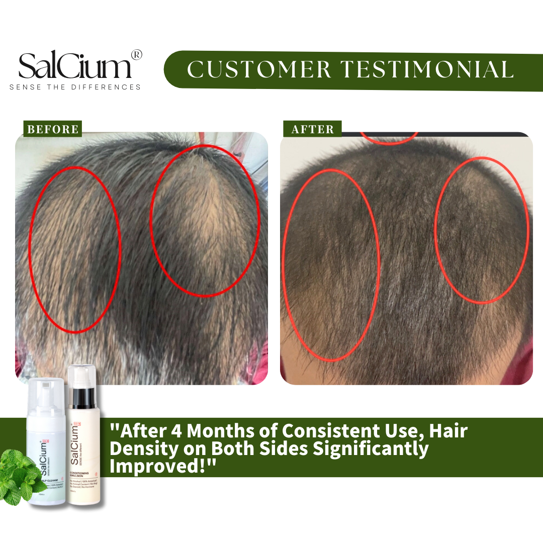 Hair Density Doubled in Just 4 Months – Real Results from Real Users!