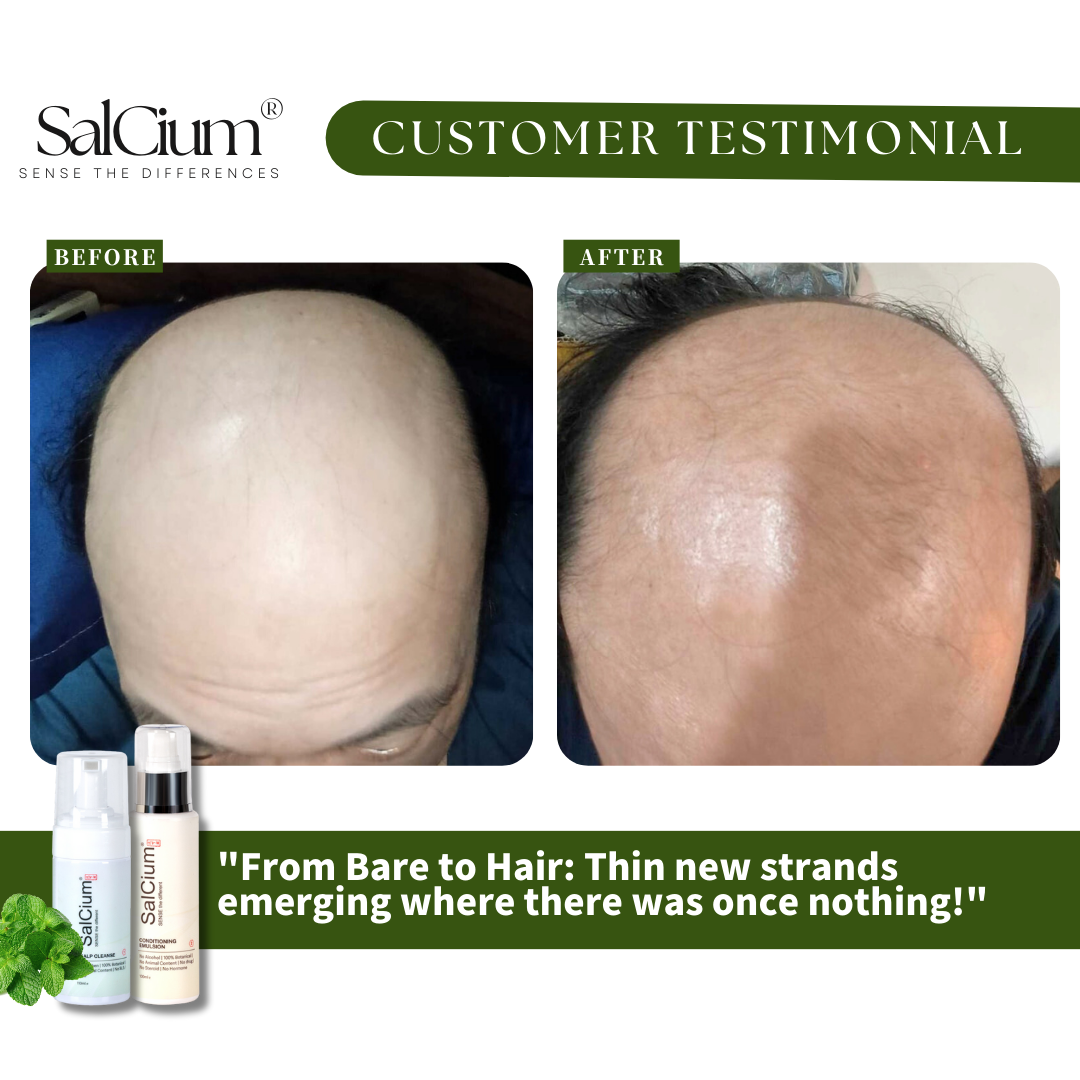 From Bare to Hair: Regrowth Where There Was Once Nothing!