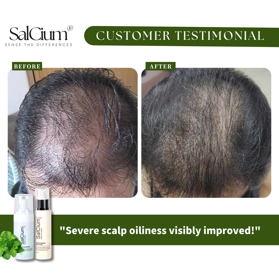 Balancing Scalp Oil: Jason’s Transformation with SalCium