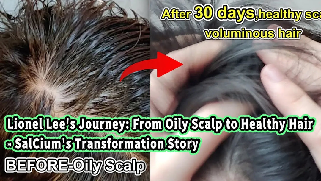 Lionel Lee's Journey: From Oily Scalp to Healthy Hair